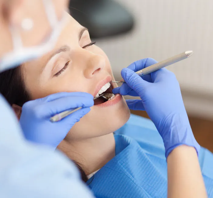 Preventive Fissure Sealants