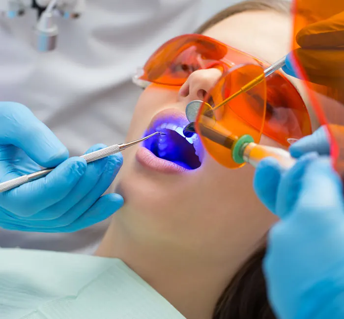 Silver Metal Fillings