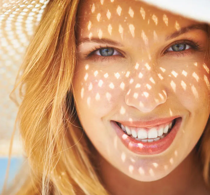 Teeth Whitening