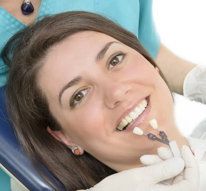 Veneers